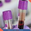 ERYTHROCYTE-SEDIMENTATION-RATE