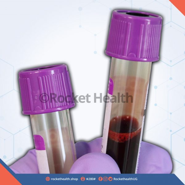 PERIPHERAL BLOOD FILM