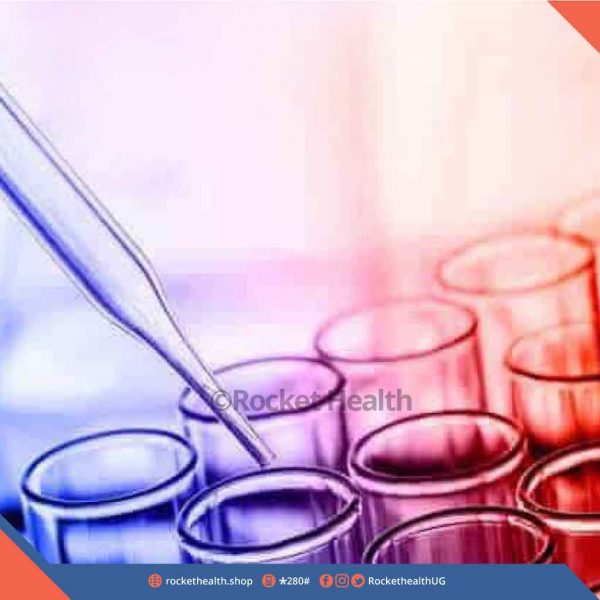 Activated-Partial-Thromboplastin-Test-(PTT)