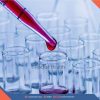 Creatinine