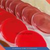Blood-Culture-And-Sensitivity-(Anaerobic)