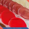 High vaginal swab culture and sensitivity